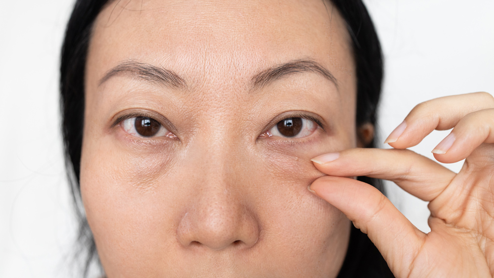 8 Clever Tricks to Banish Dark Under-Eye Circles